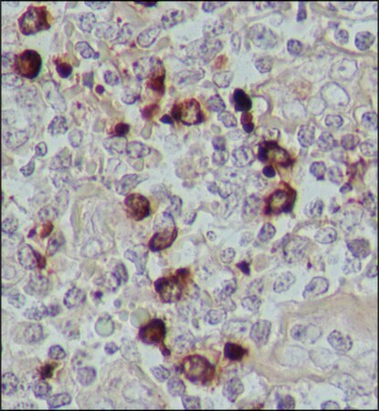 Merck Anti-Human IgA (alpha-chain specific)-Peroxidase antibody produced in goat
