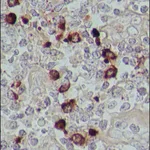 Merck Anti-Human IgA (alpha-chain specific)-Peroxidase antibody produced in goat