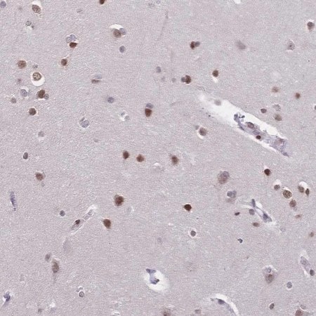 Merck Anti-CBX7 antibody produced in rabbit
