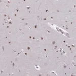 Merck Anti-CBX7 antibody produced in rabbit