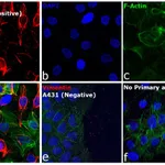 Thermo Fisher Scientific Goat anti-Mouse IgM (Heavy chain) Cross-Adsorbed Secondary Antibody, Alexa Fluor 555