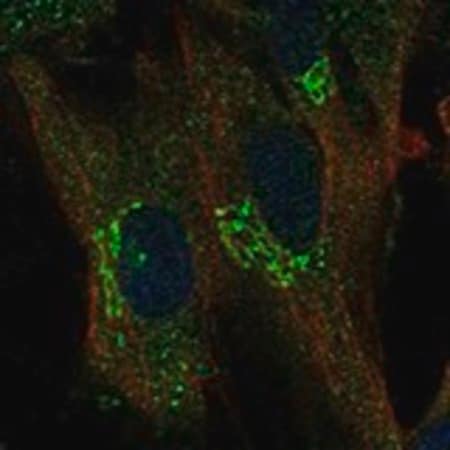 Merck Anti-TREM1 antibody produced in rabbit