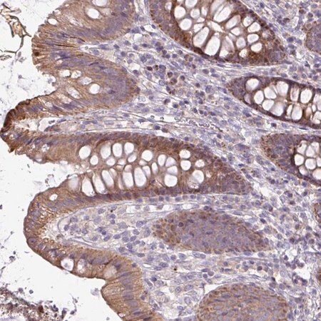 Merck Anti-STRIP1 antibody produced in rabbit