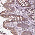 Merck Anti-STRIP1 antibody produced in rabbit