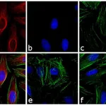 Thermo Fisher Scientific Goat anti-Mouse IgG1 Cross-Adsorbed Secondary Antibody, Alexa Fluor 633