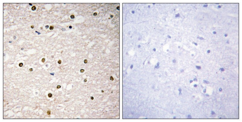 Merck Anti-P73 antibody produced in rabbit