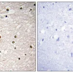 Merck Anti-P73 antibody produced in rabbit