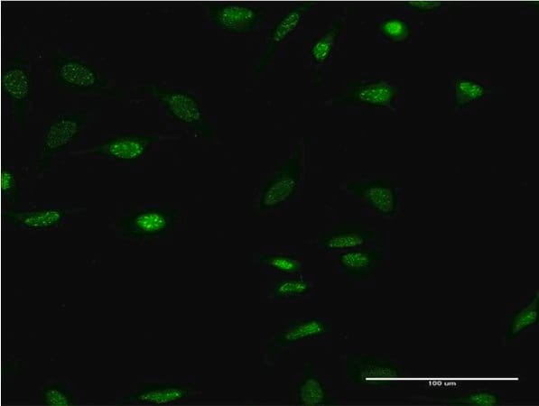 Merck Monoclonal Anti-OLIG2 antibody produced in mouse