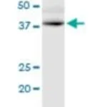 Merck MONOCLONAL ANTI-GPRC5D