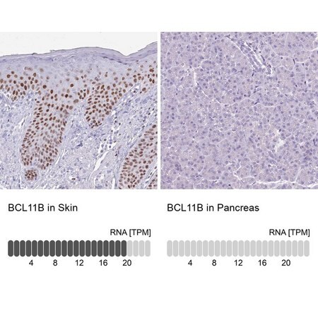 Merck Anti-BCL11B antibody produced in rabbit