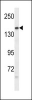 Merck ANTI-PTPRG (CENTER)