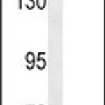 Merck ANTI-PTPRG (CENTER)