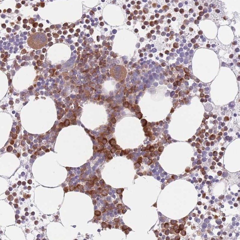 Atlas Antibodies Anti-PPM1A Antibody