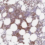 Atlas Antibodies Anti-PPM1A Antibody