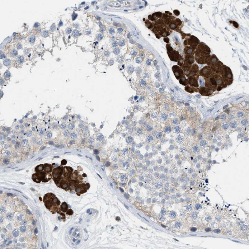 Atlas Antibodies Anti-PPM1D Antibody