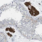 Atlas Antibodies Anti-PPM1D Antibody