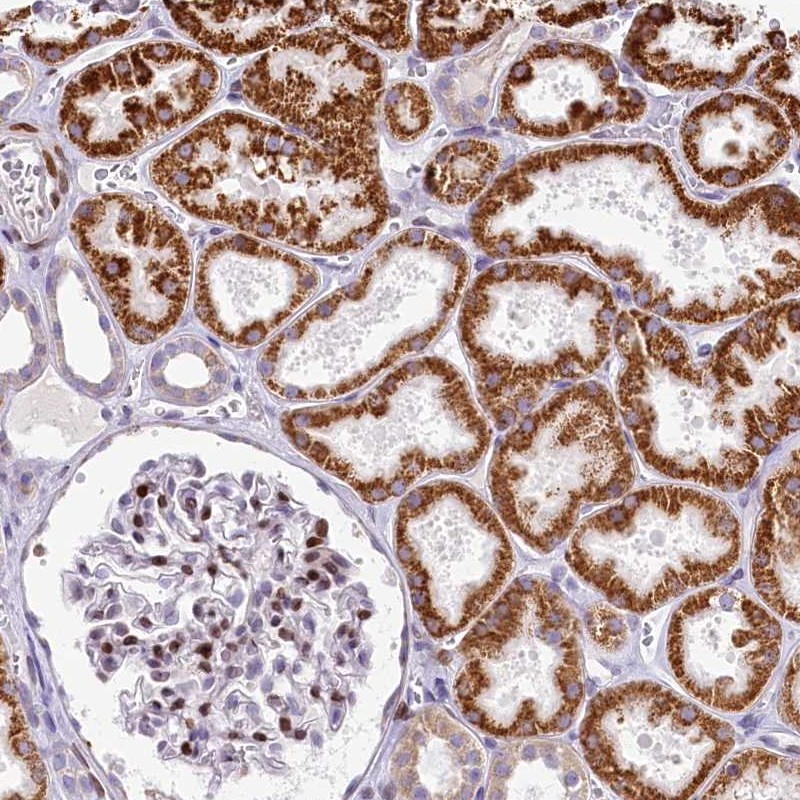 Atlas Antibodies Anti-PPIP5K2 Antibody