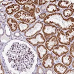 Atlas Antibodies Anti-PPIP5K2 Antibody