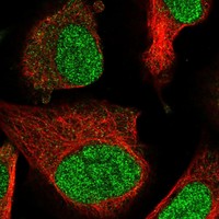 Atlas Antibodies Anti-PPM1D Antibody