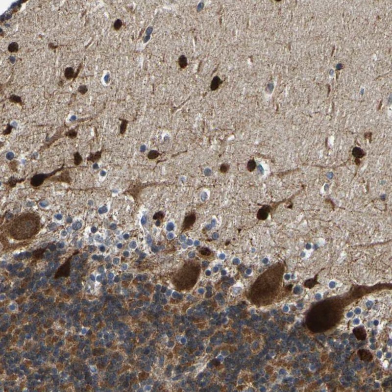 Atlas Antibodies Anti-PPM1E Antibody