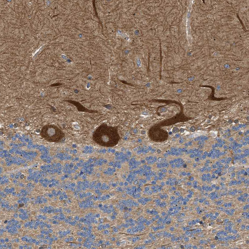 Atlas Antibodies Anti-PPM1B Antibody