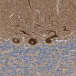 Atlas Antibodies Anti-PPM1B Antibody