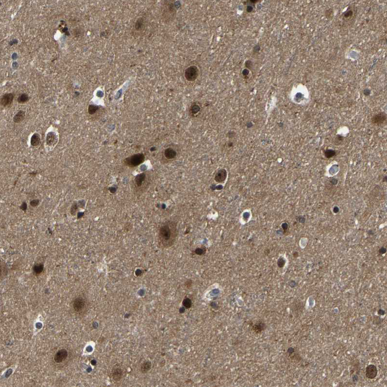 Atlas Antibodies Anti-PPM1E Antibody