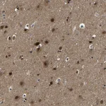 Atlas Antibodies Anti-PPM1E Antibody