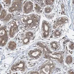 Atlas Antibodies Anti-PPM1F Antibody