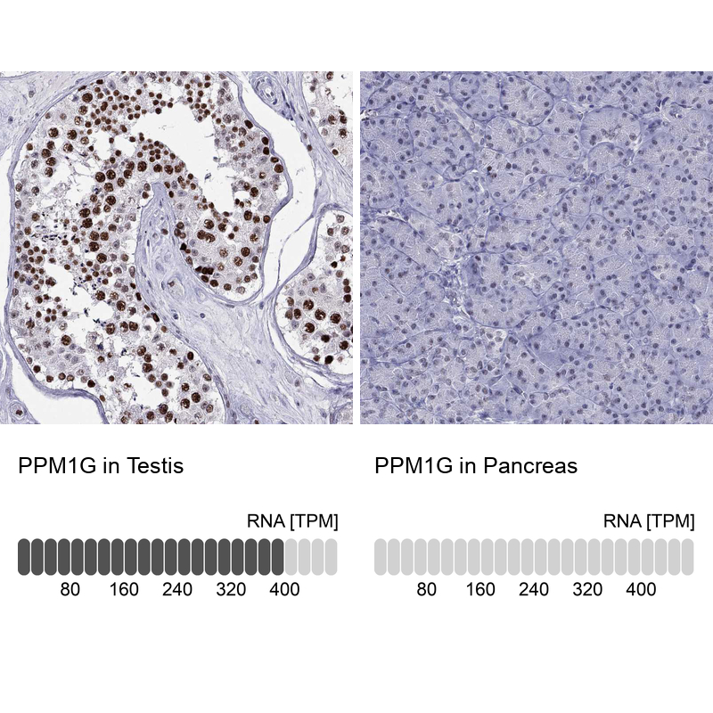 Atlas Antibodies Anti-PPM1G Antibody