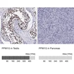 Atlas Antibodies Anti-PPM1G Antibody