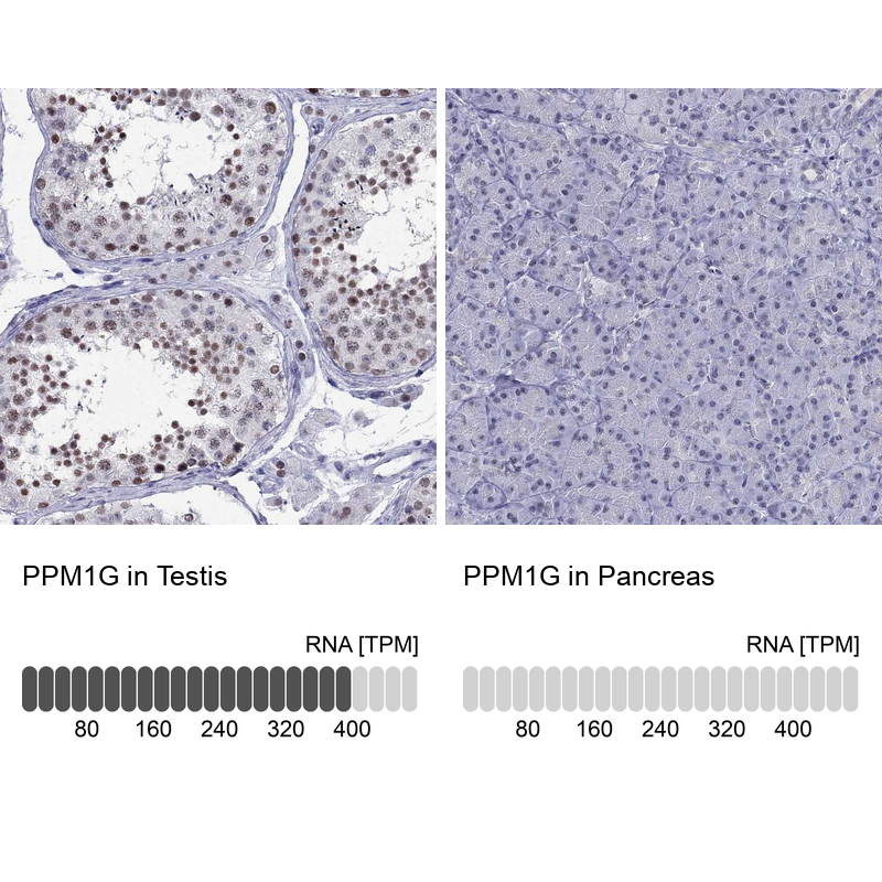 Atlas Antibodies Anti-PPM1G Antibody