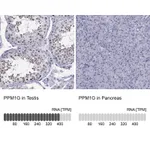 Atlas Antibodies Anti-PPM1G Antibody