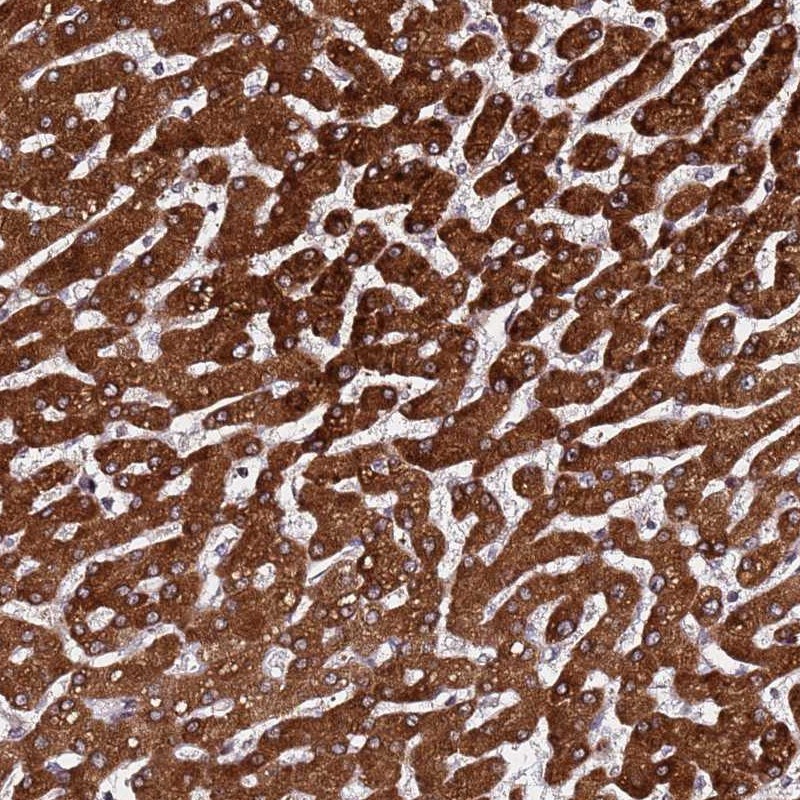 Atlas Antibodies Anti-PPM1H Antibody