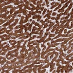 Atlas Antibodies Anti-PPM1H Antibody