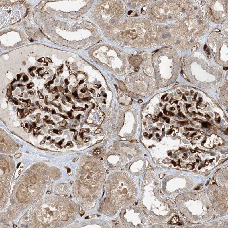 Atlas Antibodies Anti-PPM1F Antibody