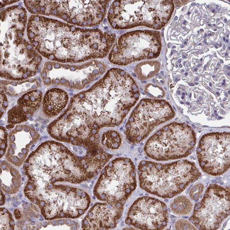 Atlas Antibodies Anti-PPM1H Antibody