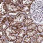 Atlas Antibodies Anti-PPM1H Antibody