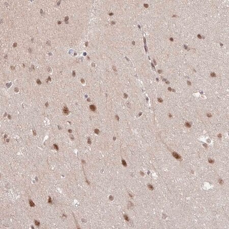 Merck Anti-NEIL1 antibody produced in rabbit