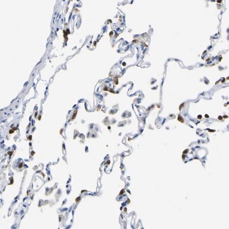 Merck Anti-ABHD3 antibody produced in rabbit