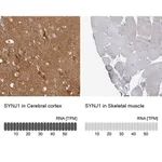 Merck Anti-SYNJ1 antibody produced in rabbit