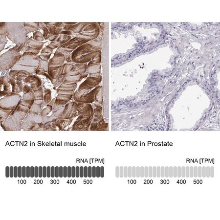 Merck Anti-ACTN2 antibody produced in rabbit