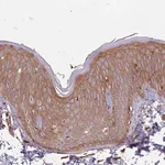 Merck Anti-ACVR2A antibody produced in rabbit