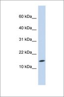Merck Anti-UBE2D3