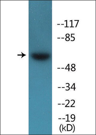 Merck Anti-phospho-Src (pTyr418) antibody produced in rabbit