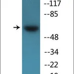 Merck Anti-phospho-Src (pTyr418) antibody produced in rabbit