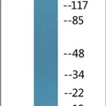 Merck ANTI-PHOSPHO-P16-INK4A (PSER152)