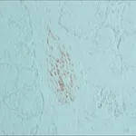 Merck ANTI-HNK-1/N-CAM (CD57) ANTIBODY, MOUSE&