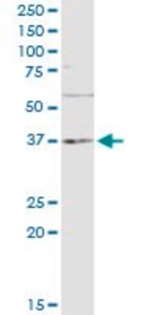 Merck Monoclonal Anti-TNF antibody produced in mouse