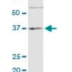Merck Monoclonal Anti-TNF antibody produced in mouse